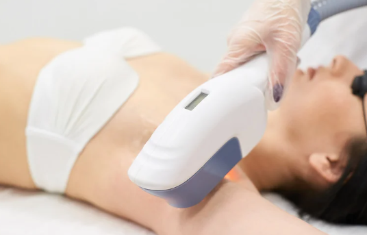 光脱毛　熱破壊式