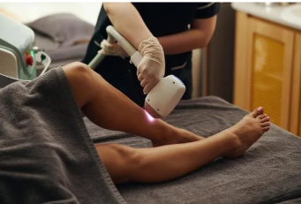 家庭用脱毛機だけでメンズの足脱毛は難しい！